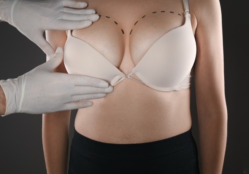 Choosing Invisible Bra Surgery: Why It's One of the Finest Options in Modern Plastic Surgery